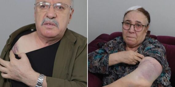 Esenyurt’ta komşu vahşeti: Yaşlı çifti sopa kırılana kadar darbettiler!