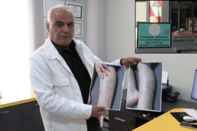 diyarbakırda torununun şiddet gördüğünü anladı (2)