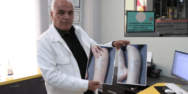 diyarbakırda torununun şiddet gördüğünü anladı (2)