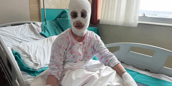 İftar saati ‘düdüklü tencere’ faciası: ‘Aynaya baktıktan sonra bayılmışım…’