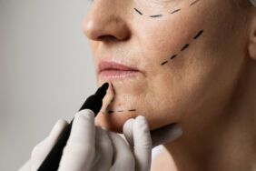 Flört uzadıkça estetiğe ilgi artıyor Operasyon talebinde yükseliş