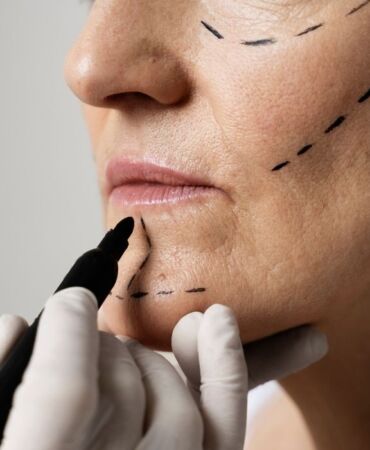 Flört uzadıkça estetiğe ilgi artıyor Operasyon talebinde yükseliş