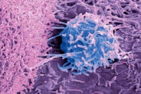 Kanser tedavisinde vitamin uyarısı 'B3 vitamini tümör büyümesini destekleyebilir'