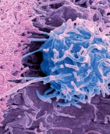 Kanser tedavisinde vitamin uyarısı 'B3 vitamini tümör büyümesini destekleyebilir'