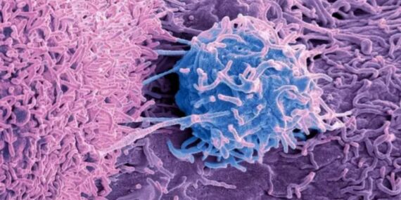 Kanser tedavisinde vitamin uyarısı: ‘B3 vitamini tümör büyümesini destekleyebilir’