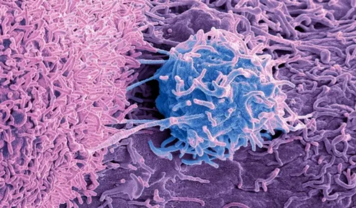 Kanser tedavisinde vitamin uyarısı 'B3 vitamini tümör büyümesini destekleyebilir'