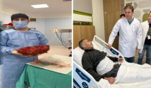 Karnından 8 kiloluk böbrek çıkarıldı