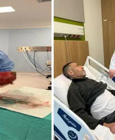 Karnından 8 kiloluk böbrek çıkarıldı