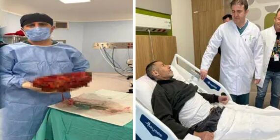 Karnından 8 kiloluk böbrek çıkarıldı!