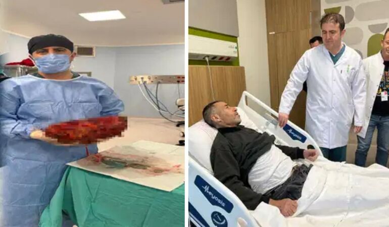 Karnından 8 kiloluk böbrek çıkarıldı!