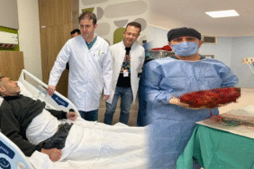 Şaşırtan vaka Karın ağrısı ve şişkinlikle gitti, 8 kilo böbrek ameliyatla alındı