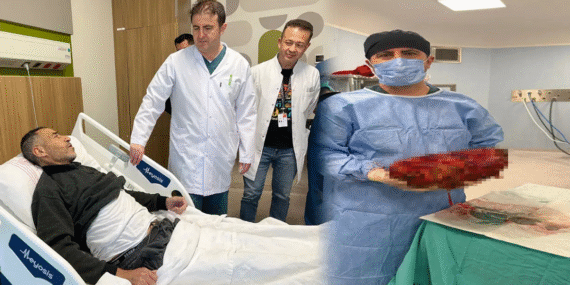 Şaşırtan vaka: Karın ağrısı ve şişkinlikle gitti, 8 kilo böbrek ameliyatla alındı