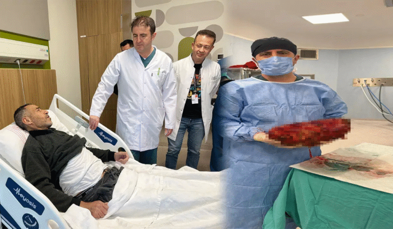 Şaşırtan vaka: Karın ağrısı ve şişkinlikle gitti, 8 kilo böbrek ameliyatla alındı