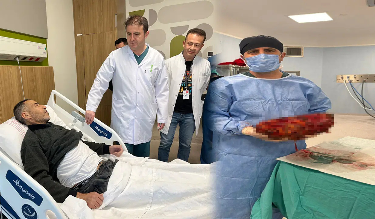 Şaşırtan vaka Karın ağrısı ve şişkinlikle gitti, 8 kilo böbrek ameliyatla alındı
