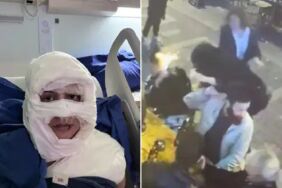 “saçlarını yakmak istedim” dedi kolonyalı saldırı davasında yeni gelişme
