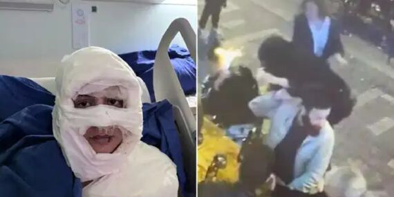 ‘Saçlarını yakmak istedim’ dedi: Kolonyalı saldırı davasında yeni gelişme!