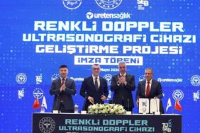 Renkli Doppler Ultrasonografi Cihazı Geliştirme Projesi