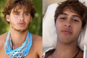 Survivor'da talihsiz kaza Bir bacağı ampute edlen yarışmacı mesajını sosyal medyadan paylaştı