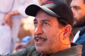 Cem Yılmaz’ın kalp krizi sonrası dikkatler bu işarete çevrildi Frank işareti ne demek