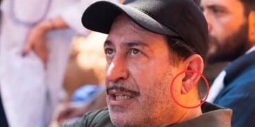 Cem Yılmaz’ın kalp krizi sonrası dikkatler bu işarete çevrildi Frank işareti ne demek