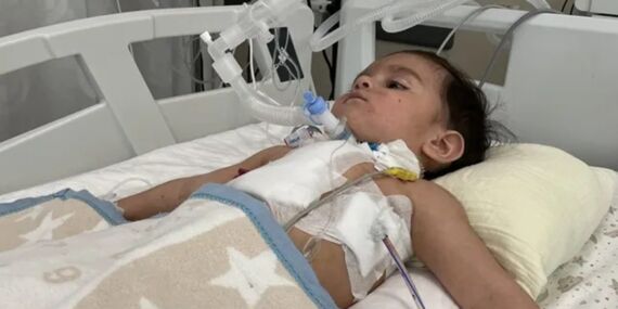 Doğum günü sonrası ölümden döndü: 1 yaşındaki bebeğin akciğerinden ceviz çıktı!