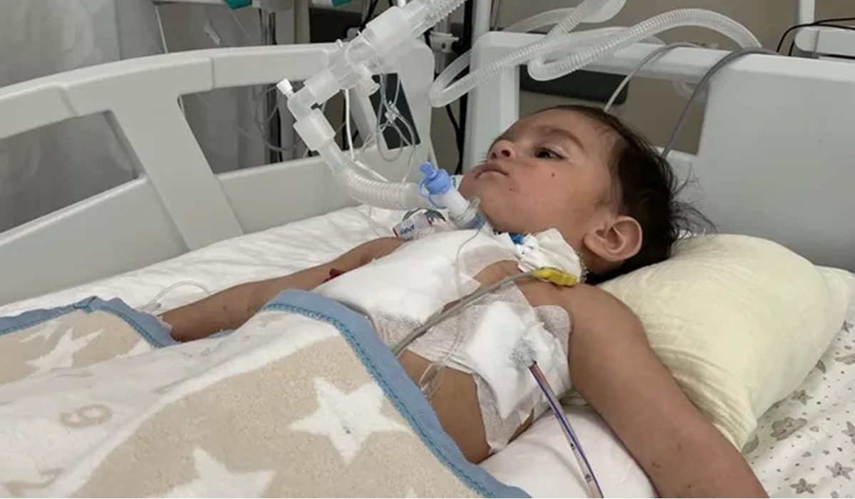 1 yaşındaki bebeğin akciğerinden ceviz çıktı